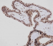 IHC testing of FFPE human retina with Retinoblastoma antibody. HIER: steam section in pH9 EDTA for 20 min and allow to cool prior to staining.