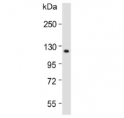 Western blot testing of human HeLa lysate with Retinoblastoma antibody. Predicted molecular weight ~110 kDa.