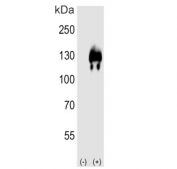 Western blot testing of 1) non-transfected and 2) transfected 293T cell lysate with Autotaxin antibody. Expected molecular weight: 99-125 kDa depending on glycosylation level.