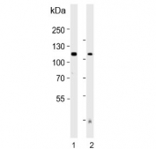 Western blot testing of human 1) placenta and 2) plasma lysate with Autotaxin antibody. Expected molecular weight: 99-125 kDa depending on glycosylation level.