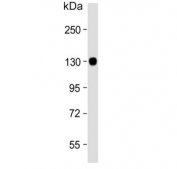Western blot testing of human brain lysate with Autotaxin antibody. Expected molecular weight: 99-125 kDa depending on glycosylation level.