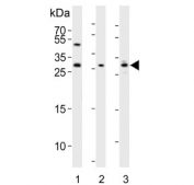 Western blot testing of 1) mouse liver, 2) mouse lung and 3) rat kidney lysate with Sclerostin antibody. Predicted molecular weight ~24 kDa.