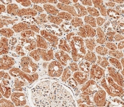 IHC testing of FFPE human kidney tissue with Sclerostin antibody. HIER: steam section in pH9 EDTA for 20 min and allow to cool prior to staining.