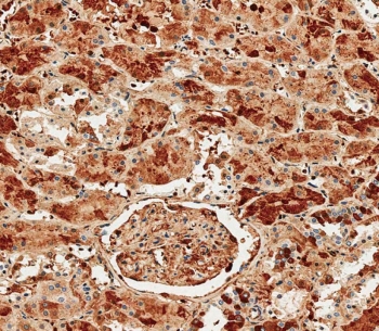 IHC testing of FFPE human kidney tissue with Albumin antibody. HIER: steam section in pH9 EDTA for 20 min and allow to cool prior to staining.