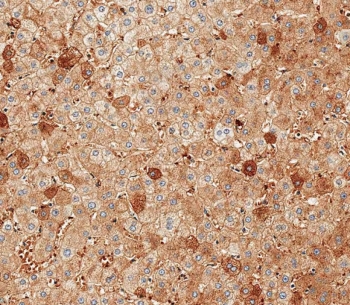 IHC testing of FFPE human liver tissue with Albumin antibody. HIER: steam section in pH9 EDTA for 20 min and allow to cool prior to staining.
