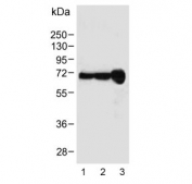 Western blot testing of 1) human HepG2, 2) human HeLa and 3) mouse liver lysate with Albumin antibody. Predicted molecular weight ~66 kDa.