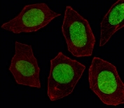 Immunofluorescent staining of fixed and permeabilized human U-251 cells with Engrailed 1 antibody (green) and anti-Actin (red).