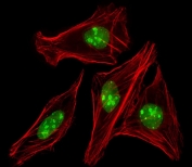 Immunofluorescent staining of fixed and permeabilized human U-2 OS cells with Engrailed 1 antibody (green) and anti-Actin (red).