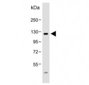 Western blot testing of mouse NIH 3T3 cell lysate with FGFR4 antibody. Expected molecular weight: 88~125 kDa depending on phosphorylation and glycosylation level.