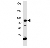 Western blot testing of human K562 cell lysate with FGFR4 antibody. Expected molecular weight: 88~125 kDa depending on phosphorylation and glycosylation level.
