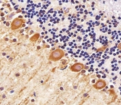 IHC testing of FFPE mouse cerebellum tissue with PPT1 antibody. HIER: steam section in pH6 citrate buffer for 20 min and allow to cool prior to staining.