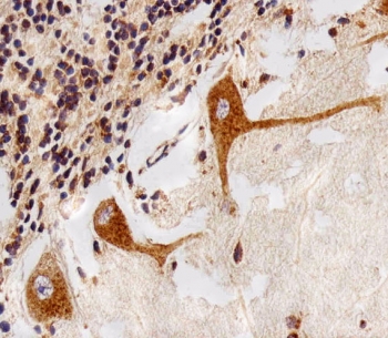 IHC testing of FFPE human cerebellum tissue with PPT1 antibody. HIER: steam section in pH6 citrate buffer for 20 min and allow to cool prior to staining.