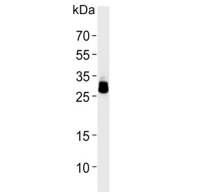 Western blot testing of human HepG2 cell lysate with PPT1 antibody. Predicted molecular weight ~34 kDa.