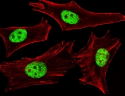 Immunofluorescent staining of fixed and permeabilized human HeLa cells with PPARA antibody (green) and anti-Actin (red).