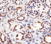IHC testing of FFPE human kidney tissue with PPARA antibody. HIER: steam section in pH6 citrate buffer for 20 min and allow to cool prior to staining.