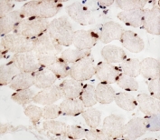 IHC testing of FFPE human skeletal muscle tissue with PPARA antibody. HIER: steam section in pH6 citrate buffer for 20 min and allow to cool prior to staining.