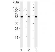 Western blot testing of 1) human HeLa, 2) human Jurkat and 3) mouse NIH 3T3 cell lysate with PPARA antibody. Predicted molecular weight ~52 kDa.