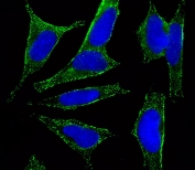 Immunofluorescent staining of fixed and permeabilized human SH-SY5Y cells with CHRM2 antibody (green) and DAPI nuclear stain (blue).