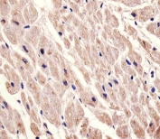 IHC testing of FFPE human heart tissue with CHRM2 antibody. HIER: steam section in pH6 citrate buffer for 20 min and allow to cool prior to staining.