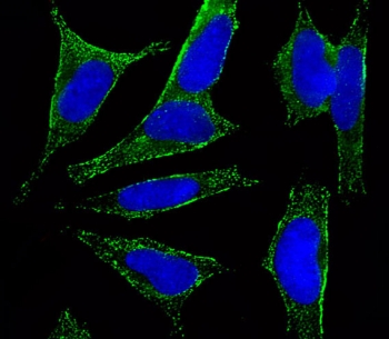 Immunofluorescent staining of fixed and permeabilized human SH-SY5Y cells with CHRM2 antibody (green) and DAPI nuclear stain (blue).