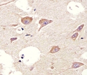 IHC testing of FFPE human brain tissue with CHRM2 antibody. HIER: steam section in pH6 citrate buffer for 20 min and allow to cool prior to staining.
