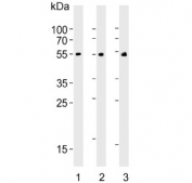 Western blot testing of 1) human SH-SY5Y, 2) human brain and 3) mouse brain lysate with CHRM2 antibody. Predicted molecular weight ~52 kDa.