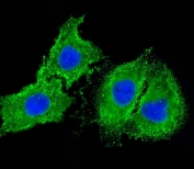 Immunofluorescent staining of fixed and permeabilized human HepG2 cells with Cytokeratin 18 antibody (green) and DAPI nuclear stain (blue).