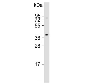 Western blot testing of mouse NIH 3T3 cell lysate with Angiotensin II Type 1 Receptor antibody. Observed molecular weight: 41-50 kDa depending on glycosylation level.
