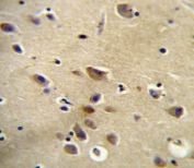 IHC testing of FFPE human brain tissue with Angiotensin II Type 1 Receptor antibody. HIER: steam section in pH6 citrate buffer for 20 min and allow to cool prior to staining.