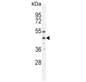 Western blot testing of human HepG2 cell lysate with Angiotensin II Type 1 Receptor antibody. Observed molecular weight: 41-50 kDa depending on glycosylation level.