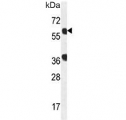 Western blot testing of mouse NIH 3T3 cell lysate with GTPBP2 antibody. Predicted molecular weight 66 kDa with a possible ~46 kDa mutation product.