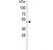 Western blot testing of human K562 cell lysate with GTPBP2 antibody. Predicted molecular weight 66 kDa with a possible ~46 kDa mutation product.