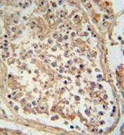 IHC testing of FFPE human testis tissue with GTPBP2 antibody. HIER: steam section in pH6 citrate buffer for 20 min and allow to cool prior to staining.