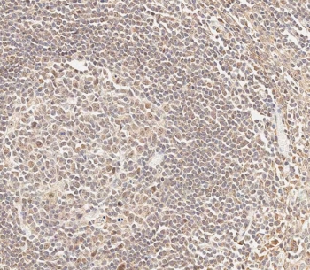 IHC testing of FFPE human tonsil tissue with CEPT1 antibody. HIER: steam section in pH9 EDTA for 20 min and allow to cool prior to staining.