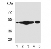 Western blot testing of human 1) HL60, 2) HeLa, 3) cerebellum, 4) SK-BR-3 and 5) mouse brain lysate with CEPT1 antibody. Predicted molecular weight ~47 kDa.