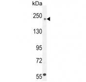 Western blot testing of human U251 cell lysate with COL5A1 antibody. Predicted molecular weight ~184 kDa but can be observed at up to ~250 kDa.