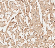 IHC testing of FFPE human heart tissue with COL5A1 antibody. HIER: steam section in pH9 EDTA for 20 min and allow to cool prior to staining.