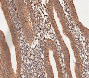 IHC testing of FFPE human uterus tissue with COL5A1 antibody. HIER: steam section in pH9 EDTA for 20 min and allow to cool prior to staining.