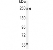 Western blot testing of mouse bladder lysate with COL5A1 antibody. Predicted molecular weight ~184 kDa but can be observed at up to ~250 kDa.