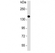 Western blot testing of human HeLa cell lysate with COL5A1 antibody. Predicted molecular weight ~184 kDa but can be observed at up to ~250 kDa.