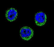Immunofluorescent staining of fixed and permeabilized human MDA-MB-435 cells with Haptoglobin antibody (green) and DAPI nuclear stain (blue).