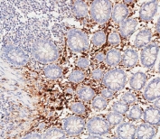 IHC testing of FFPE human colon tissue with Haptoglobin antibody. HIER: steam section in pH9 EDTA for 20 min and allow to cool prior to staining.