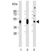 Western blot testing of 1) human liver, 2) human plasma and 3) mouse plasma lysate with Haptoglobin antibody. Predicted molecular weight ~45 kDa.