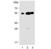 Western blot testing of human 1) heart, 2) breast and 3) placenta lysate with ENT1 antibody.  Predicted molecular weight ~50 kDa.