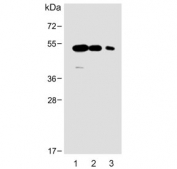 Western blot testing of human 1) brain, 2) breast and 3) placenta lysate with ENT1 antibody.  Predicted molecular weight ~50 kDa.
