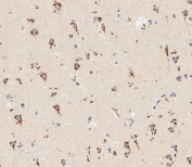 IHC testing of FFPE human brain tissue with ENT1 antibody. HIER: steam section in pH9 EDTA for 20 min and allow to cool prior to staining.