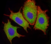 Immunofluorescent staining of fixed and permeabilized human HepG2 cells with Complement factor H antibody (green), DAPI nuclear stain (blue) and anti-Actin (red).