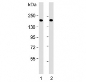 Western blot testing of human 1) lung and 2) plasma lysate with Complement factor H antibody. Predicted molecular weight ~139 kDa but may be observed at a higher molecular weight due to glycosylation.