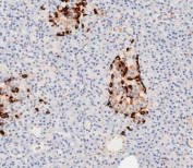 IHC testing of FFPE human pancreas tissue with Clusterin antibody. HIER: steam section in pH9 EDTA for 20 min and allow to cool prior to staining.