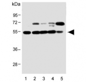 Western blot testing of human 1) HepG2, 2) MCF7, 3) Caco-2, 4) HeLa and 5) A549 lysate with Clusterin antibody. 